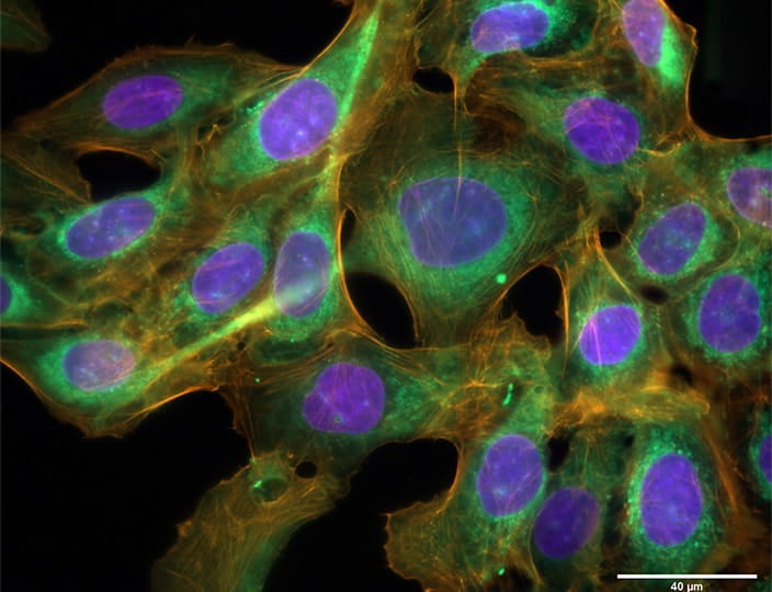 Automated Fluorescence Microscopy