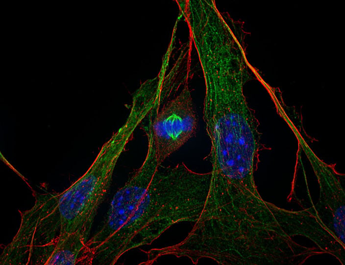 Super-Resolution and Confocal Microscopy